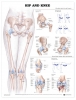 Anatomical Poster - Hip & Knee Injuries
