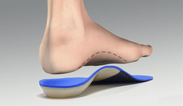 A guide to creating the most effective orthotics